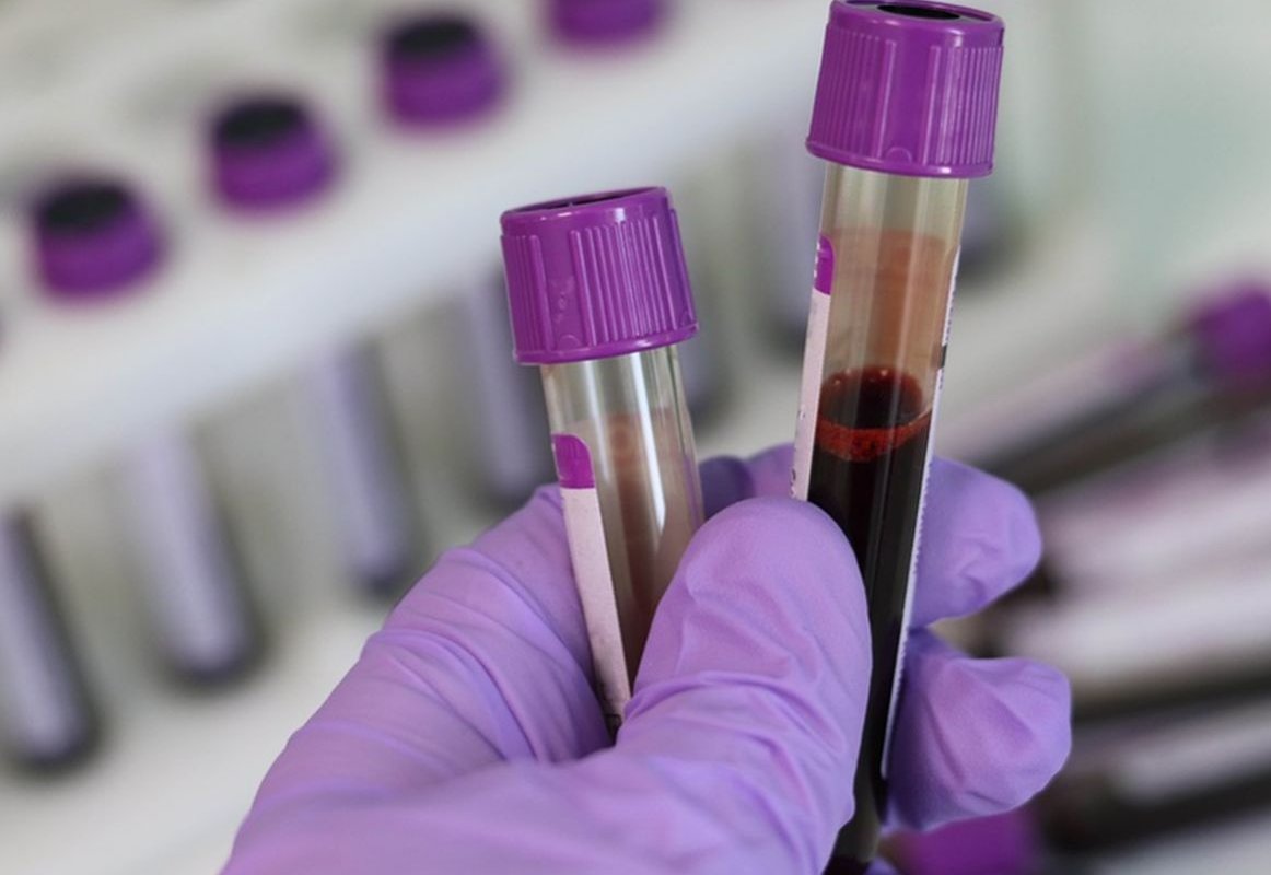 Вирусолог Нетесов: как группа крови может влиять на тяжесть ковида